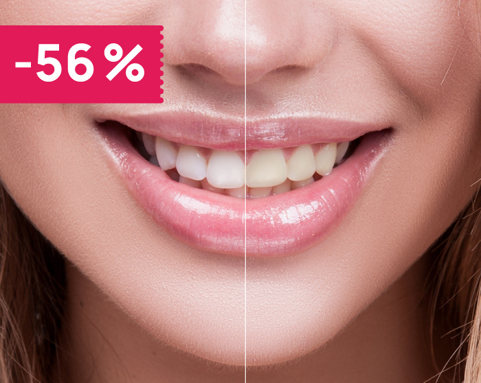 Wybielanie zębów Lampą LED